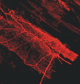 Abbildung zeigt eine schematische Darstellung von Blutgefäßen.