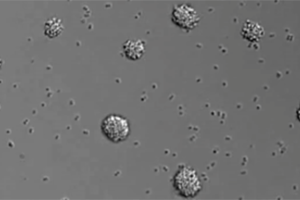 Das Foto zeigt mehrere Bakterienkolonien auf grauem Hintergrund.
