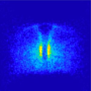 Forscher legten Mikroskopiebilder von Hunderten Zebrafischembryonen digital übereinander. So konnten sie Muster in der Urkeimzellwanderung erkennen und Gewebe identifizieren, die diese beeinflussen. (Foto: Gross-Thebing, Truszkowski, Tenbrinck et al. Sci Adv 2020;6: eabc5546/CC BY-NC)