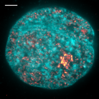 Mittels Superauflösungsmikroskopie aufgenommenes Bild der Transkription in einem Zellkern. DNA ist blau dargestellt, transkribierende Polymerase in gelb. Maßstabsleiste entspricht 2 Mikrometern. (Copyright: Hilbert et al. / MPI-CBG)