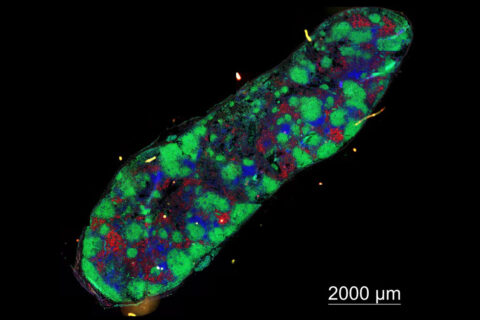 Der Lymphknoten einer an SLE erkrankten Maus, in dem es zu einer starken Vermehrung Autoantikörper-produzierender Plasmazellen (in rot dargestellt) gekommen ist. Neben den Plasmazellen sind auch B-Zellen (grün) und T-Zellen angefärbt, deren Zusammenspiel die Grundlage für die spätere Autoimmunantwort ist. (Bild: FAU/Lehrstuhl für Genetik)