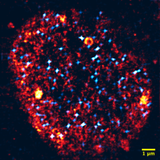 Mikroskopiebild eines Zellkerns: Transkriptionsfabriken in Orange, aktivierte Gene in Hellblau. Der Zellkern misst ca. ein Zehntel der Dicke eines menschlichen Haares. (Abbildung: Arbeitsgruppen Nienhaus und Hilbert, KIT)